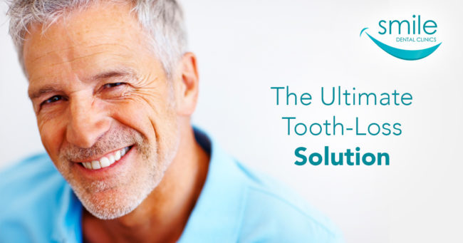 Smiling older gentleman advertising a solution to missing teeth