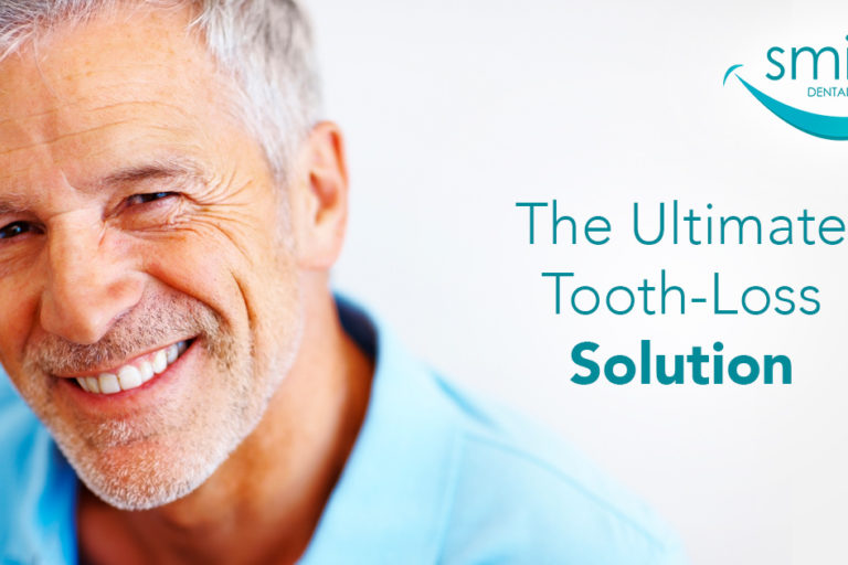 Smiling older gentleman advertising a solution to missing teeth