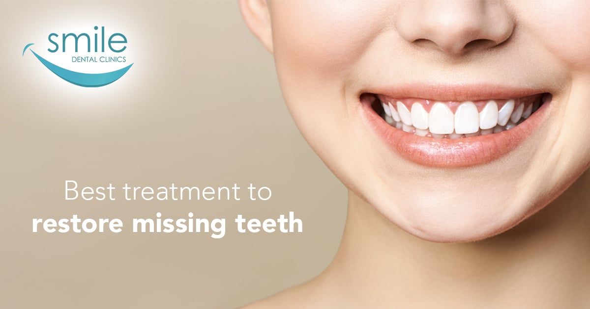 Smiling woman advertising dental implants