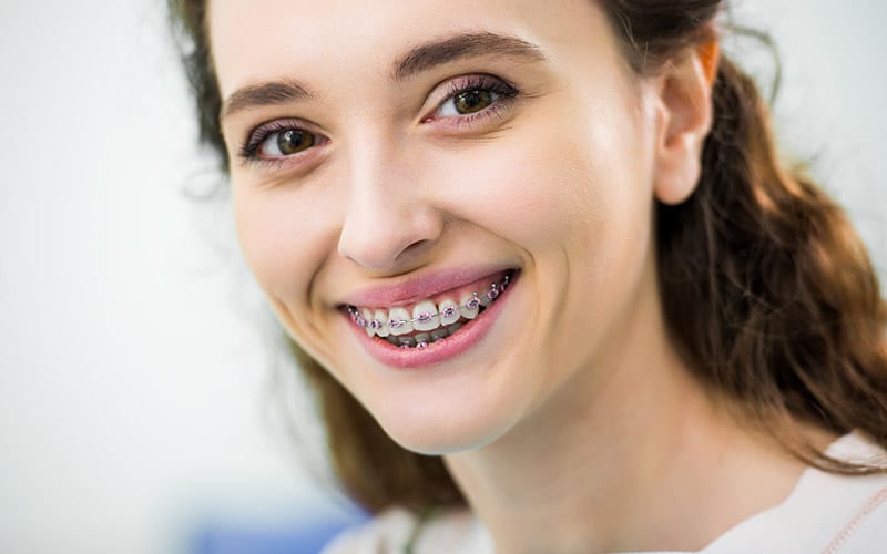 Woman with braces, smiling