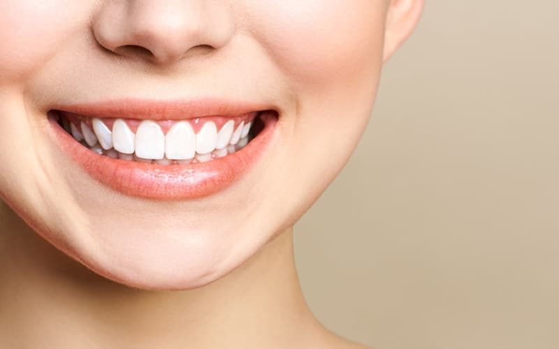 close-up shot of smiling woman's mouth and teeth
