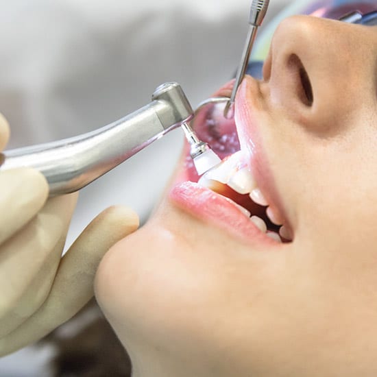 sdc-misc-cleanings-2 woman having a dental cleaning
