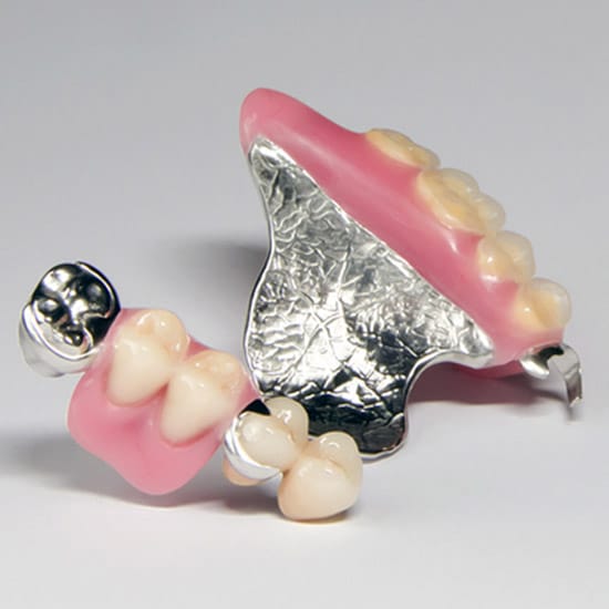 partial dentures example