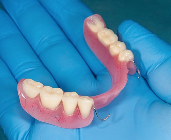 partial dentures example