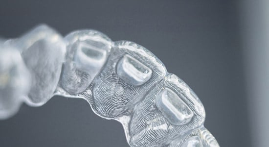sdc-misc-invisalign-3 Invisalign tray