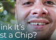 Man showing chipped tooth