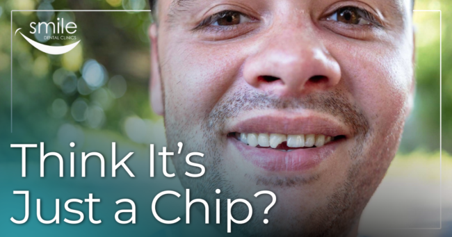 Think it’s Just a Chip? Man showing chipped tooth