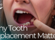 patient showing missing tooth