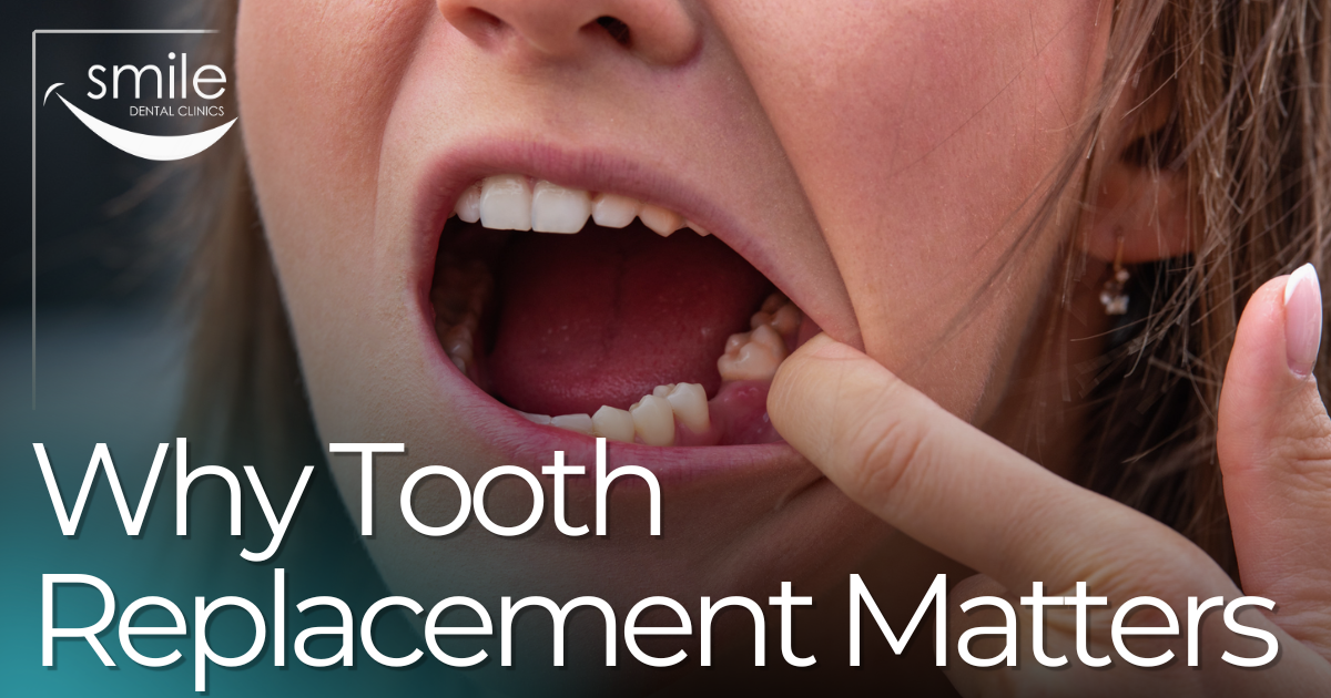 Why Tooth Replacement Matters patient showing missing tooth